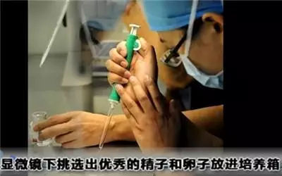 做试管婴儿的全场视频,揭秘试管婴儿的全过程