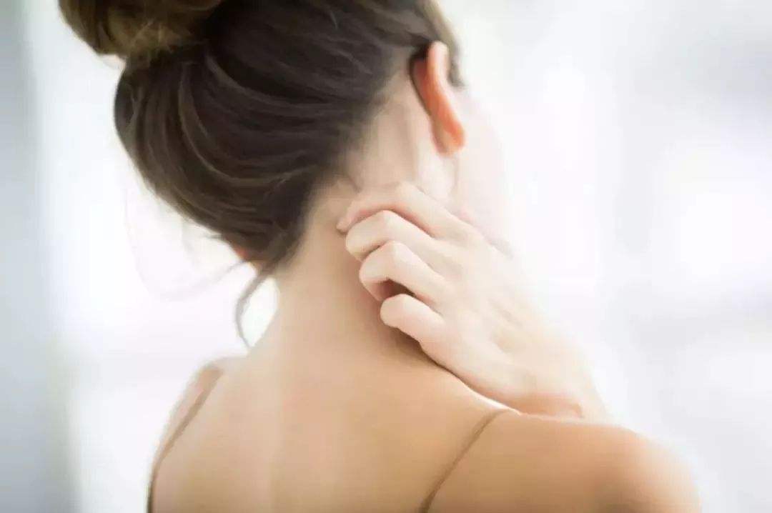 皮肤上有小黑点点是皮肤癌吗,癌症身上起小红点很痒图片