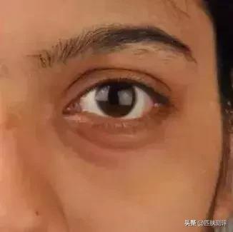 平价眼霜推荐抗皱去黑眼圈,祛眼袋和黑眼圈的平价眼霜