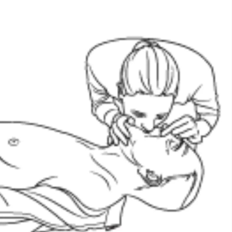 人手必备急救常识之心肺复苏术,急救技术心肺复苏术操作教学视频