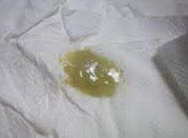 咽喉有痰胸口堵是什么原因,早上起床咽喉有黄痰是什么原因