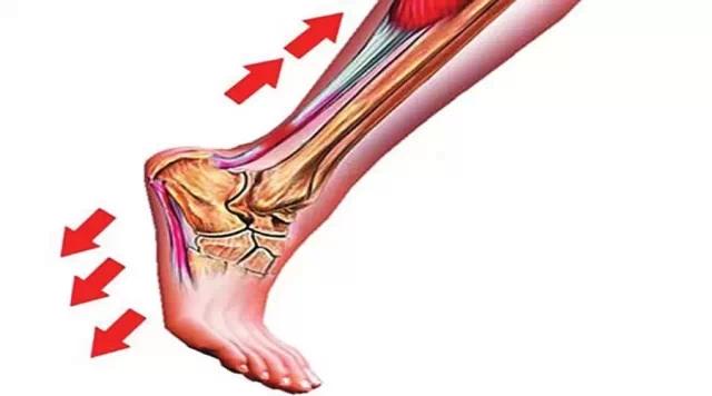 脚后跟一踩地就疼能治好吗,骨科医生告诉你足底痛的8个问题