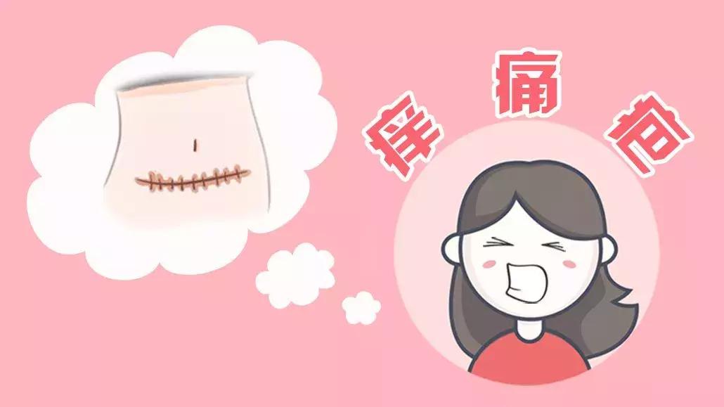 产后刀口又痒又痛的原因居然是这个?
