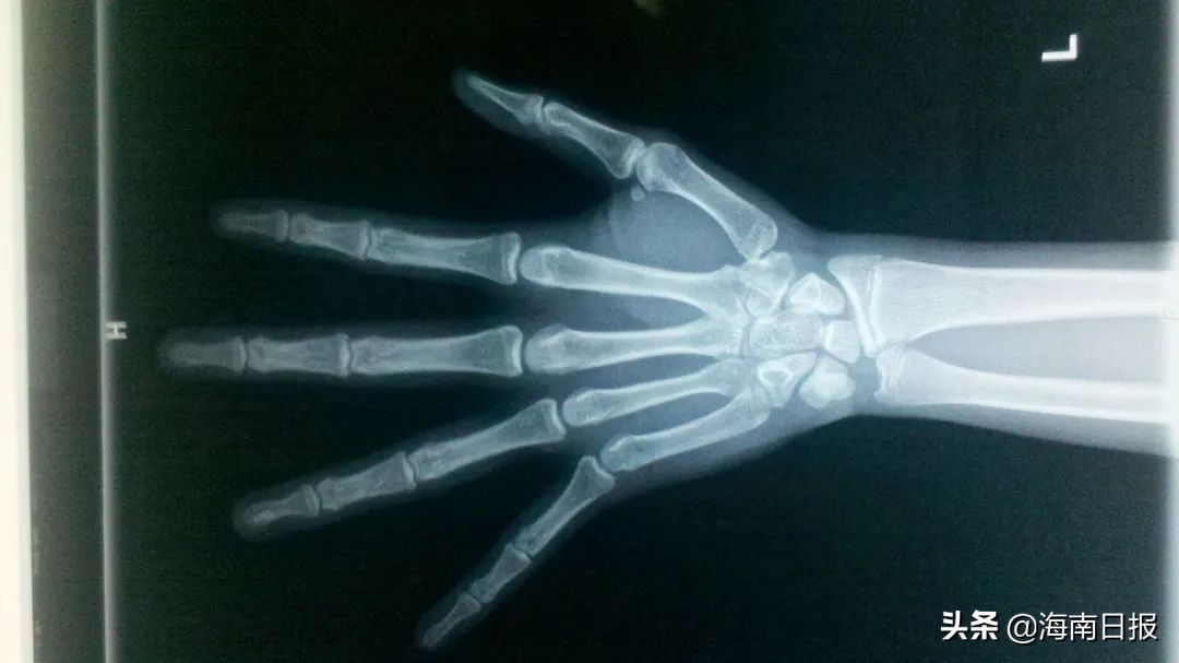 注意以下几点助力孩子快快长高,如何逆天长高