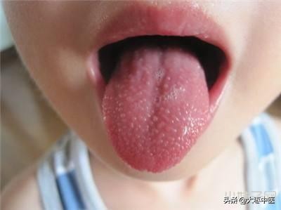 宝宝舌头能反映什么病,看孩子的舌头知道身体状况