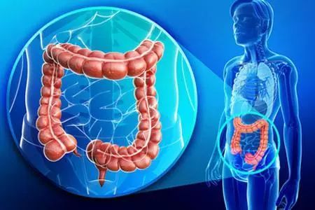 腹腔镜结直肠癌手术,结直肠癌术后复发能再次手术吗