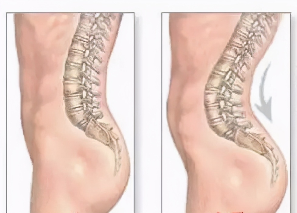 生完孩子坐月子腰疼怎么缓解,产后腰疼的厉害吃什么