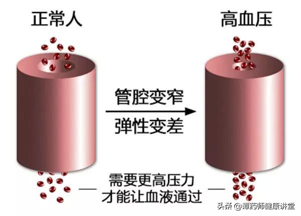 老人夜里血压正常白天血压偏低,老人血压时高时低怎么回事