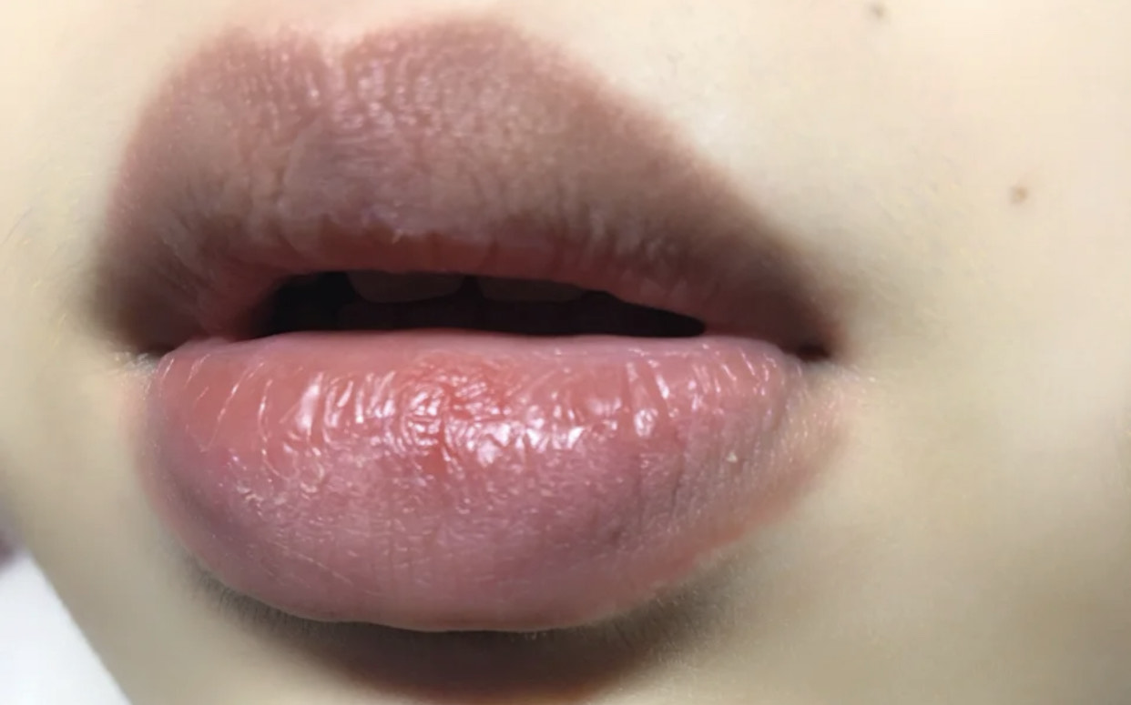 唇干唇裂涂什么唇膏比较好,唇干唇裂用什么唇油