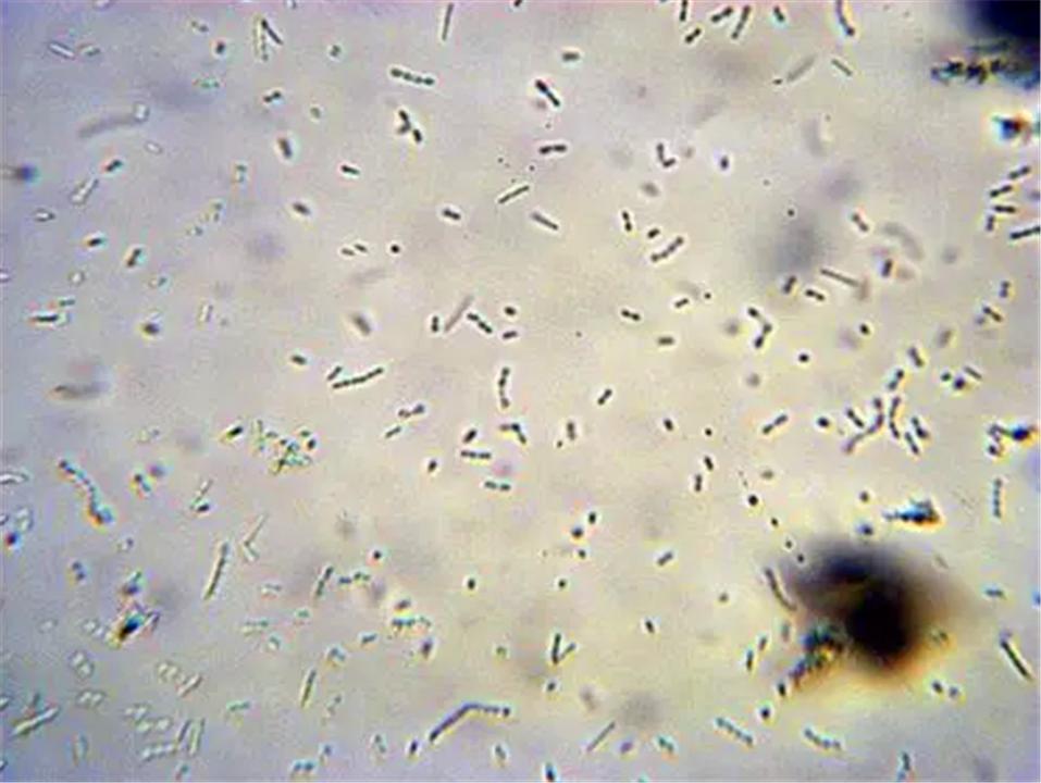 肚脐眼里的泥用显微镜放大,肚脐眼用显微镜放大1000倍