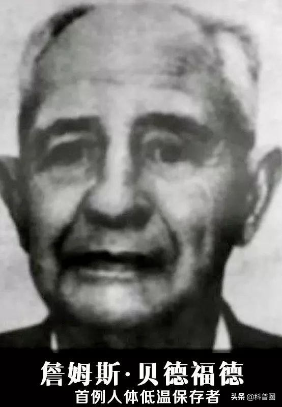冷冻人詹姆斯贝德福现状,冰冻人贝德福现状