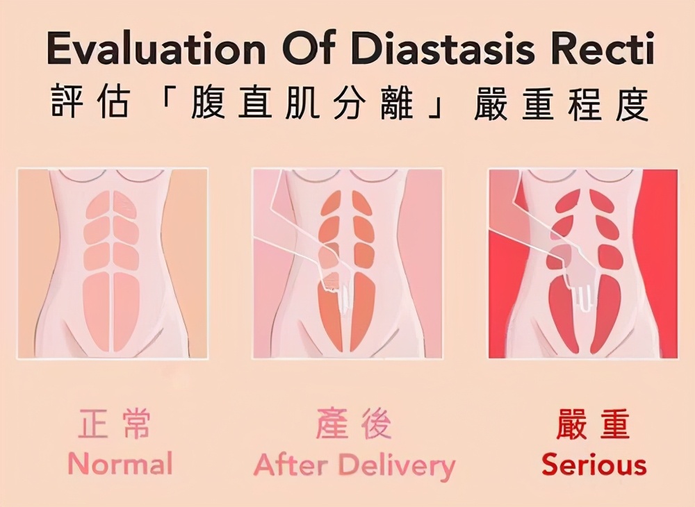 生孩子后容易衰老的特征,为何女性产后衰老那么快