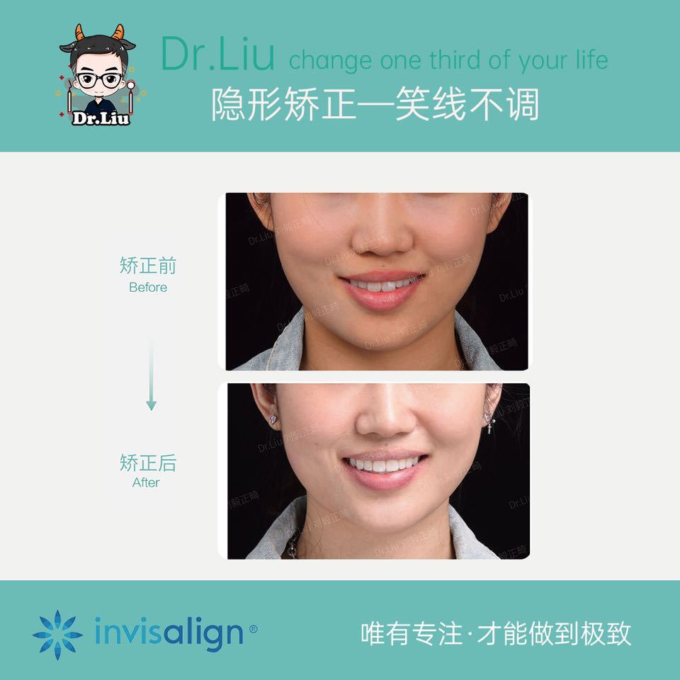 鍘﹂棬鐗欓娇缇庡,鍘﹂棬鐗欓娇鐭闅愬舰姝g暩