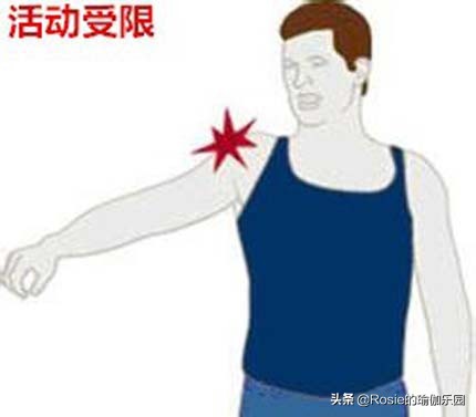 改善肩膀驼背的方法,驼背肩膀锻炼姿势