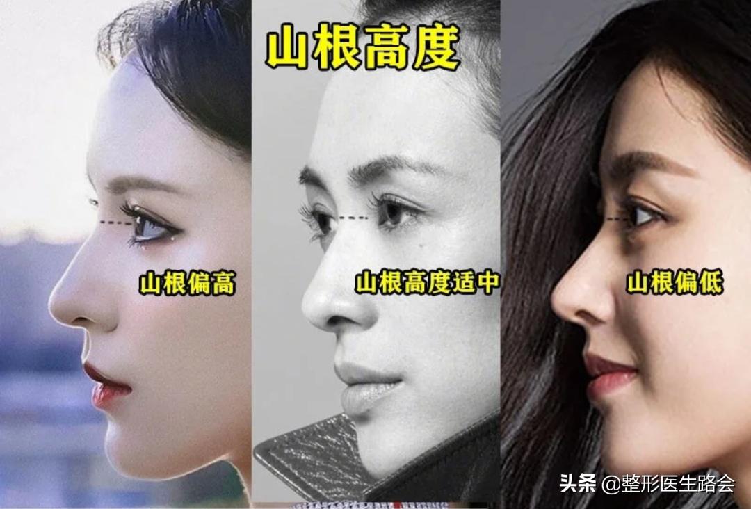 直鼻微翘怎么整,直鼻微翘怎么做出来自然又好看