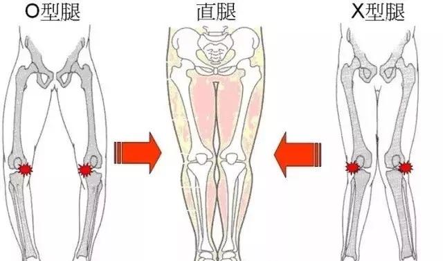 怎么练成大长腿懒人动作,如何练成笔直大长腿