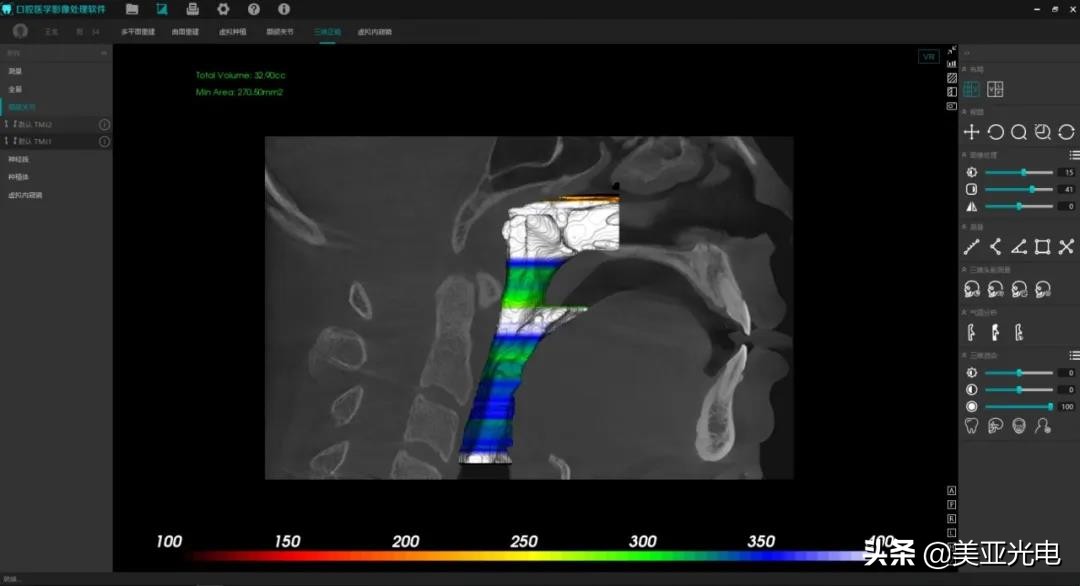 美亚口腔cbct全新局部ct功能上线,口腔cbct最好的品牌