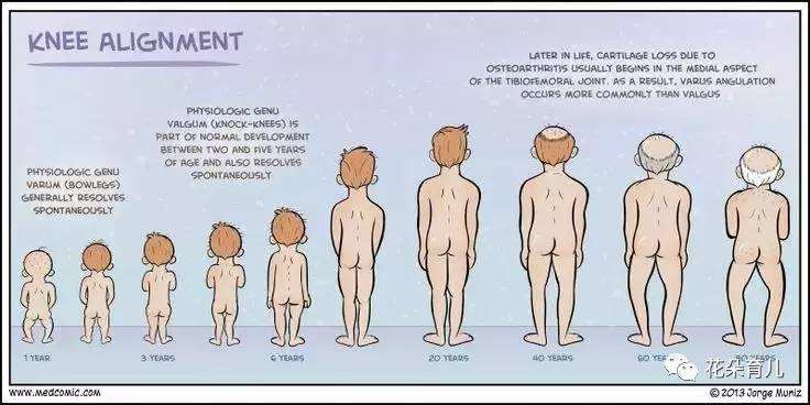 怎么判断宝宝腿型是否正常,宝宝腿型什么时候干预