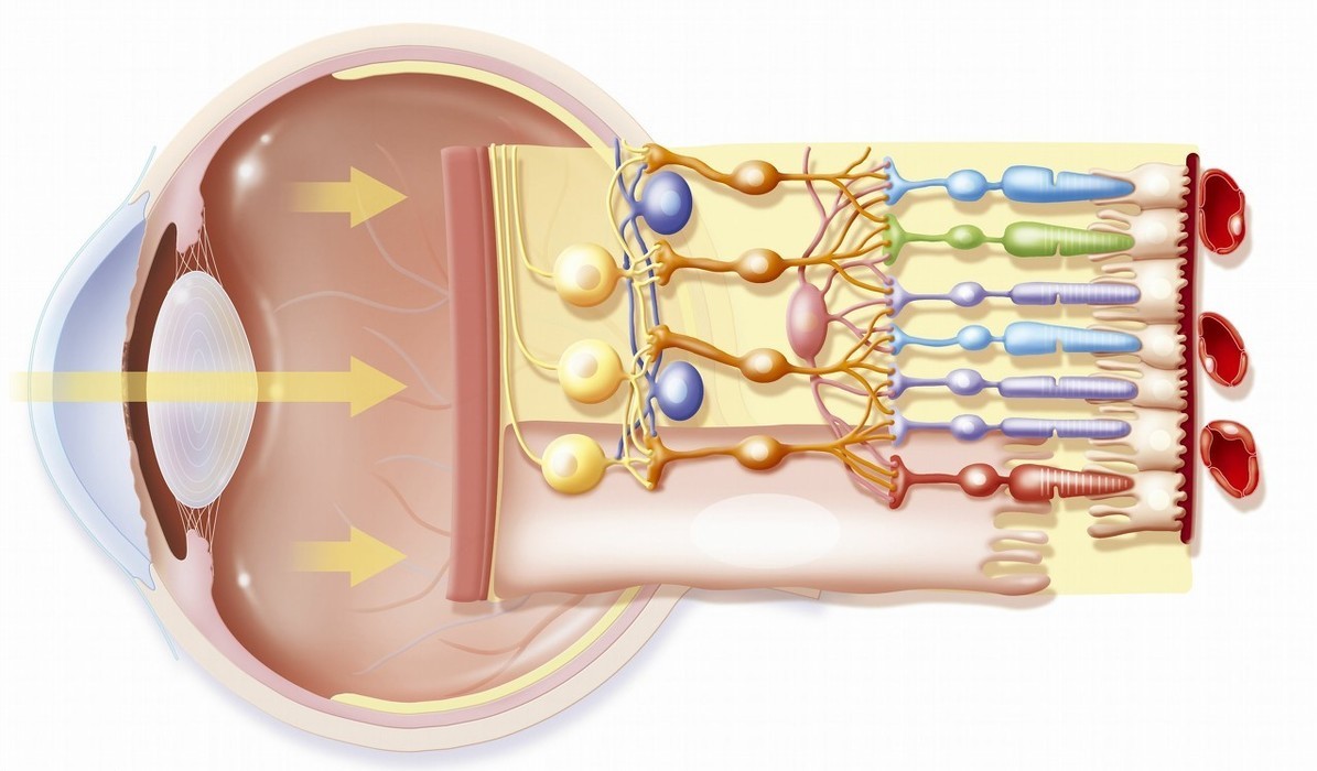 高度近视练举重可以吗,倒立对高度近视眼有没有影响