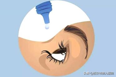 眼睛里长肉,眼睛翼状胬肉需要治疗吗