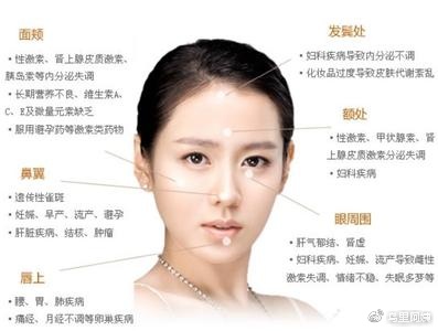 震惊｜|你都长斑了还不长点心，小心其他疾病找上你