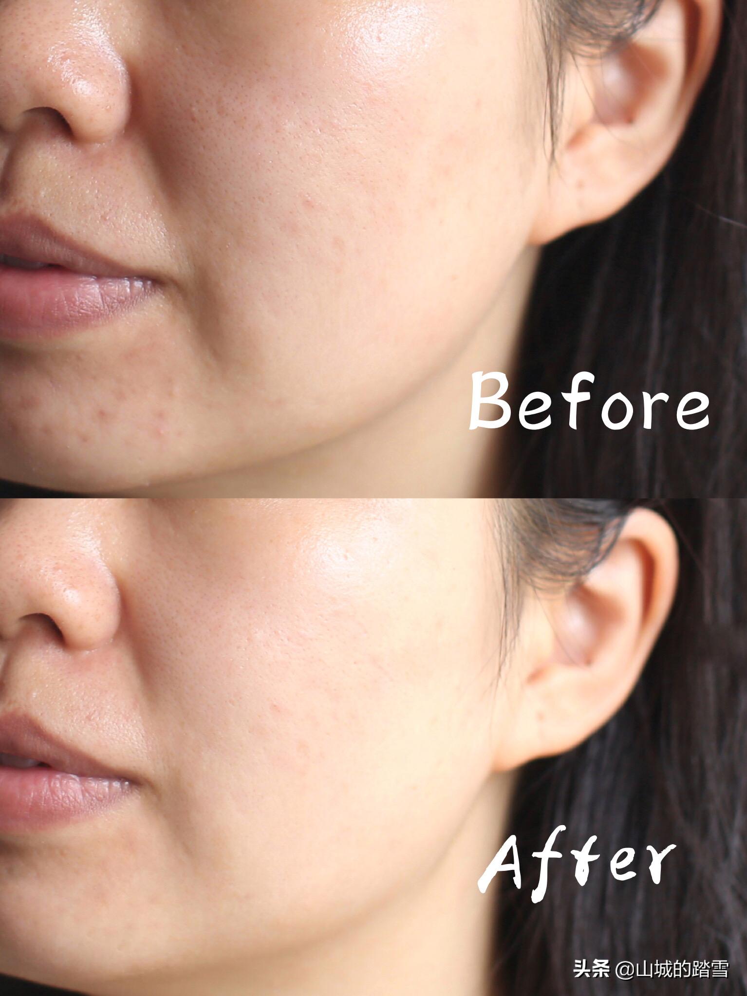 贴面膜护肤的正确步骤,敷面膜护肤的正确全步骤