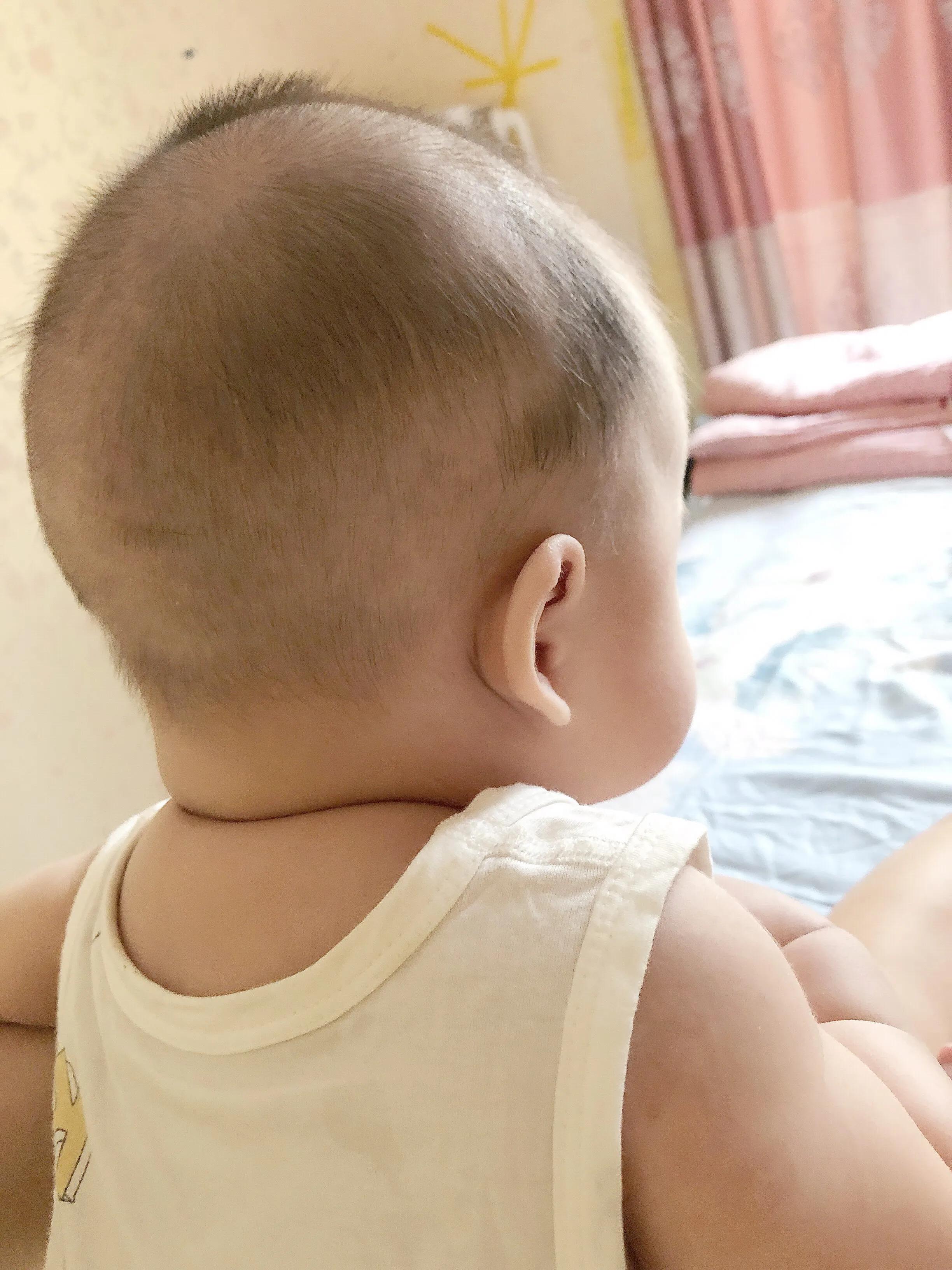 宝宝轻微偏头怎么纠正,偏头宝宝可以在偏头那边侧睡吗