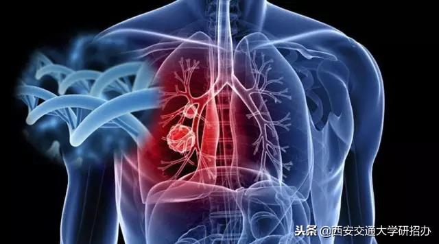 控制肺癌的药物,抑制肺癌最新研究