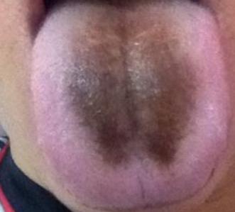 胃病怎么得来的,胃病都是怎么来的