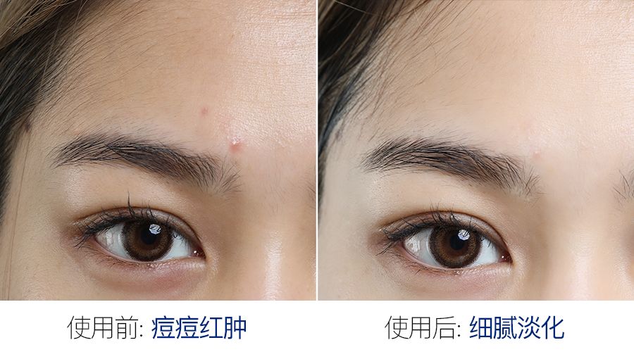 神奇紧致抗皱面膜,神奇面膜一键变老