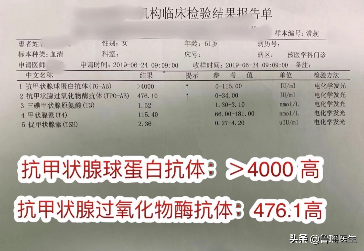 病例分享：桥本氏甲状腺炎是一种什么病？需要手术吗？