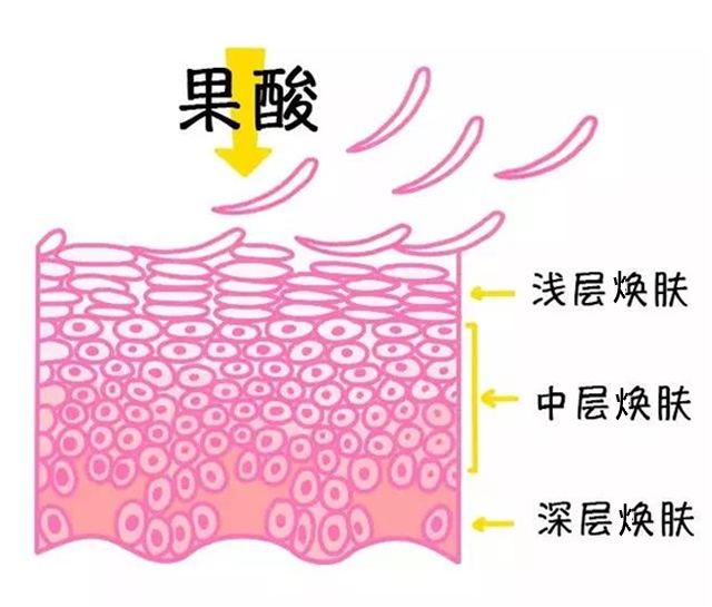 光子嫩肤果酸嫩肤,水润嫩肤适合什么皮肤