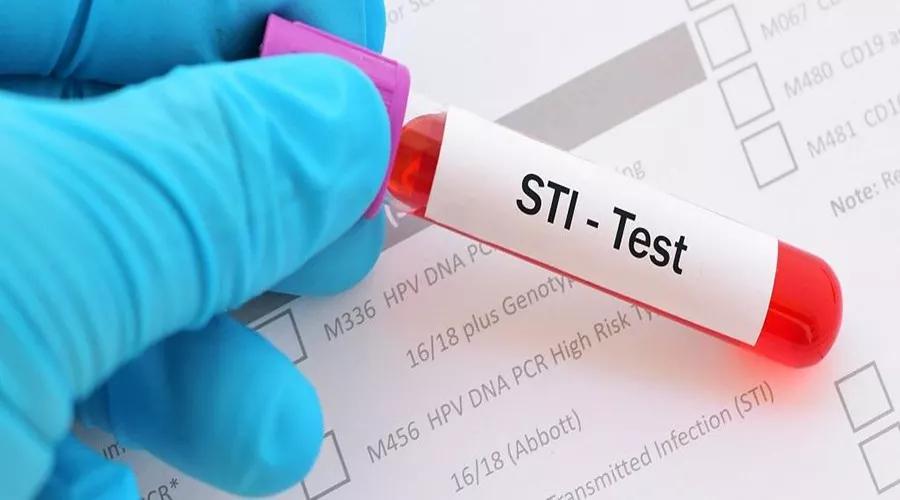 男孩尿液混浊的原因,吃鱼后尿液混浊是什么原因