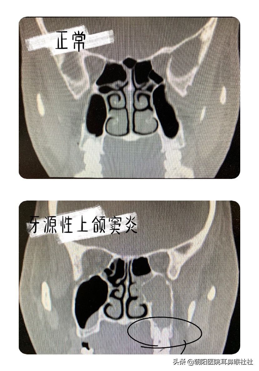 我明明是来看牙的，怎么鼻子做了手术呢？