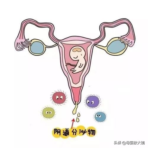 在孕早期孕妇应注意哪些问题,孕妈妈需警惕的产前几大症状