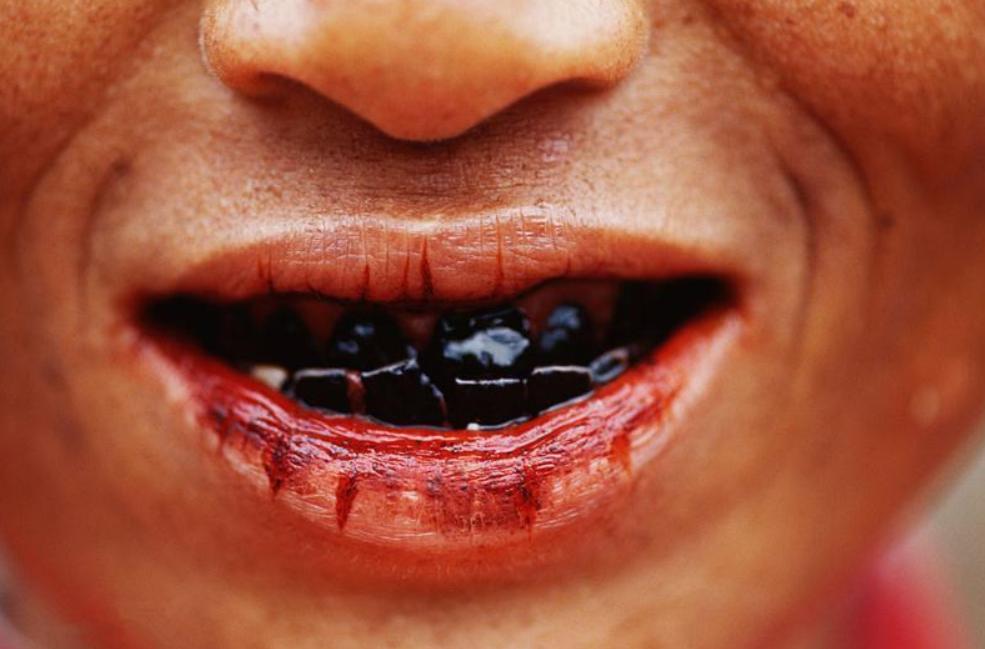 嚼槟榔到底有多大的危害,槟榔的毒性到底有多强