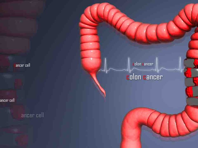 左侧腹部疼看什么科,左侧腹部疼是什么病