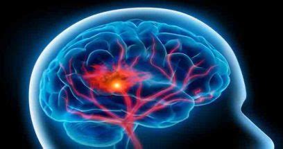 高血压能不能引起高颅压,高血压吃哪种药降低颅压