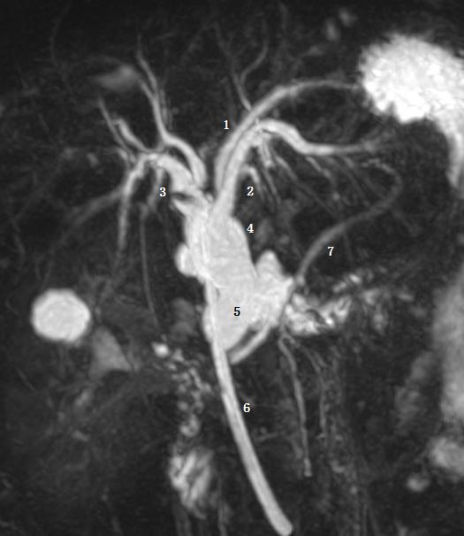 胆道系统解剖生理讲课视频,超声胆道系统的解剖生理