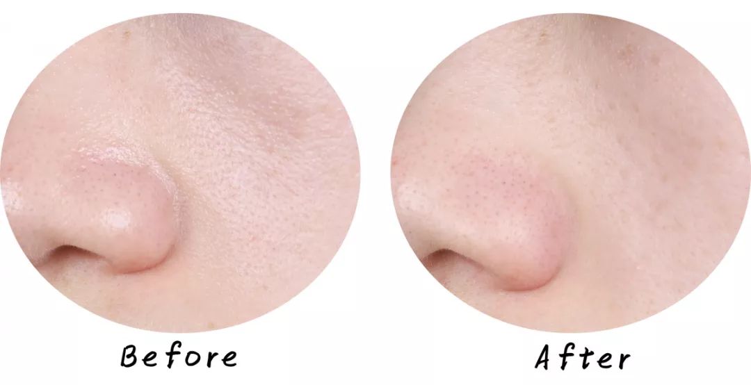 十大清洁面膜排行榜混合性皮肤,十大好用清洁面膜