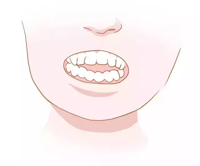 一分钟带你看牙齿矫正的全过程,最常见的牙齿矫正问题速度收藏