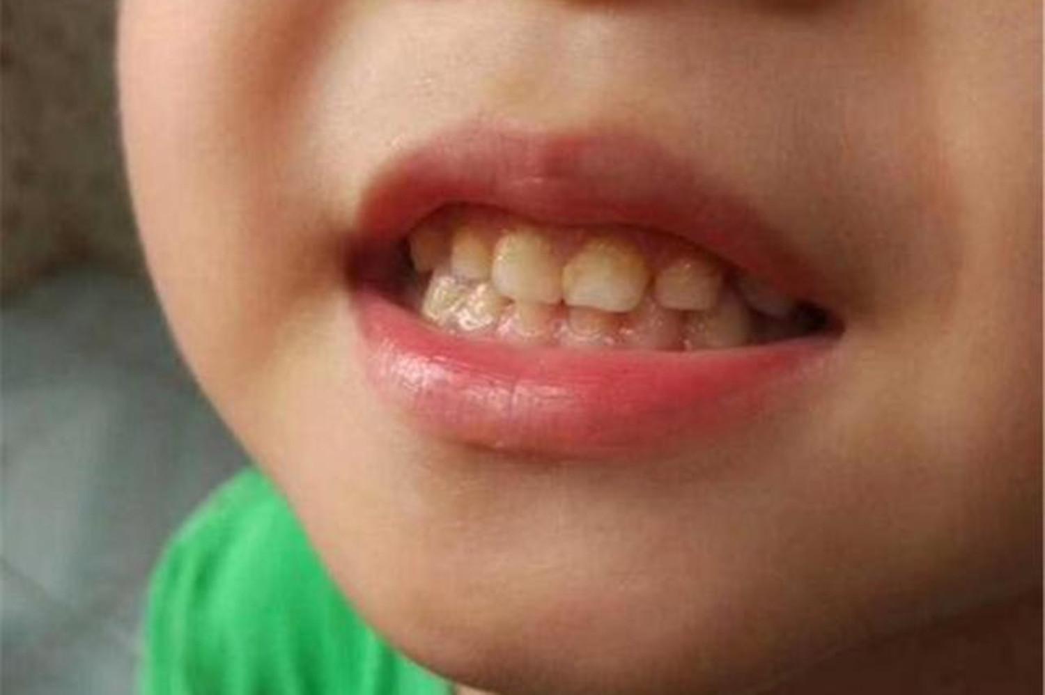 小孩天天刷牙嘴还是臭是怎么回事,小孩不喜欢刷牙嘴巴很臭怎么办