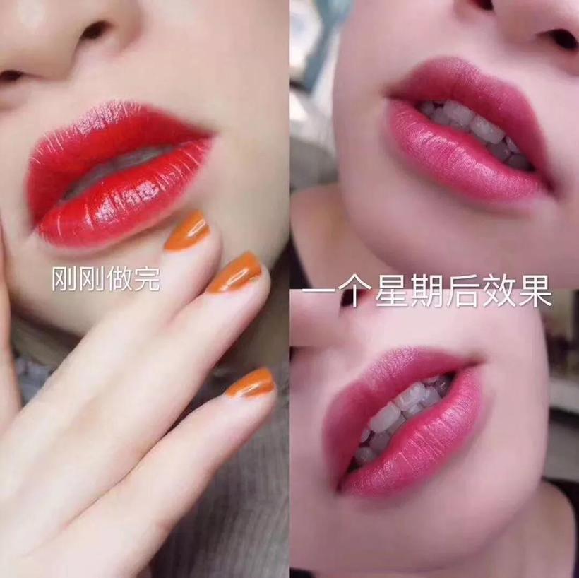 深圳传奇光学科技美容,深圳传奇光学祛斑仪器