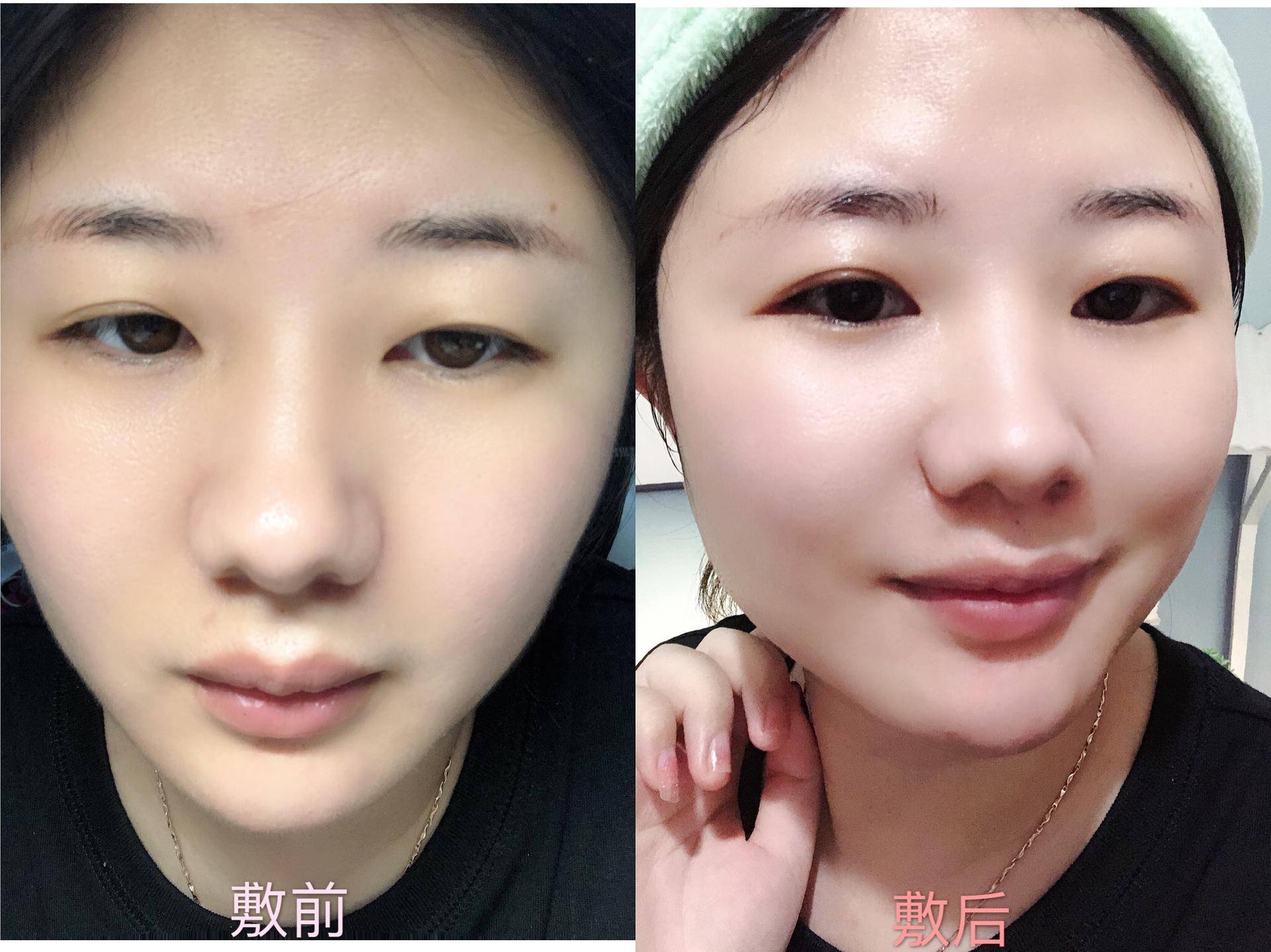 脸部医用冷敷贴怎么用效果好,面部护理冷敷贴