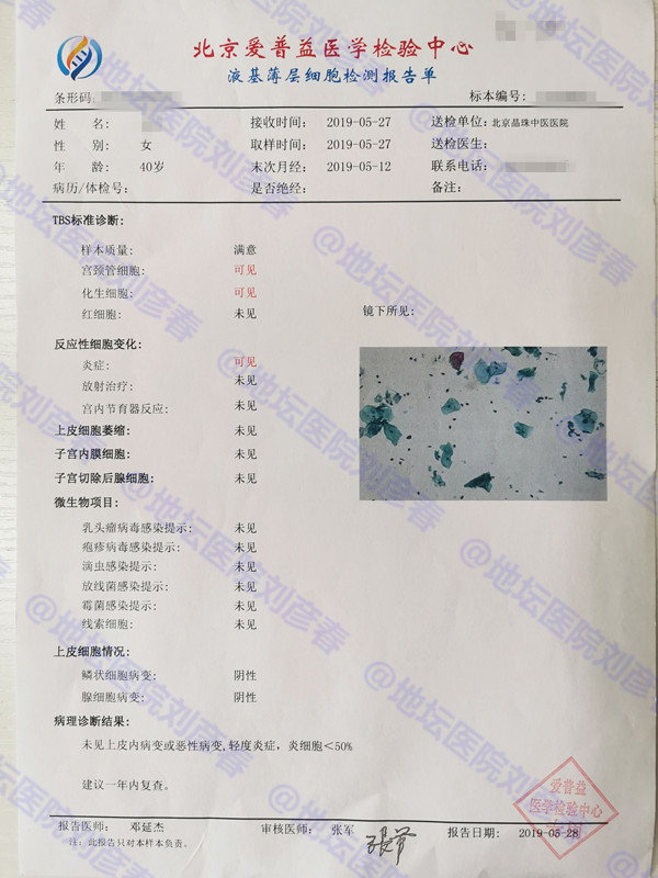 hpv16cin3锥切后会转阴几率,病例分享报告