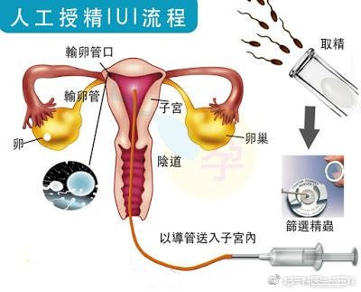 种公猪人工授精,人工授精怎么做