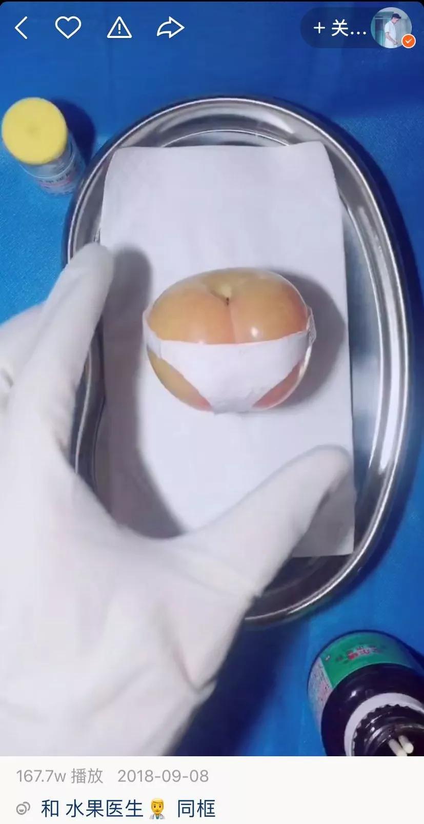 香蕉割包皮,洋葱剖腹产?这是我见过最秀的医生