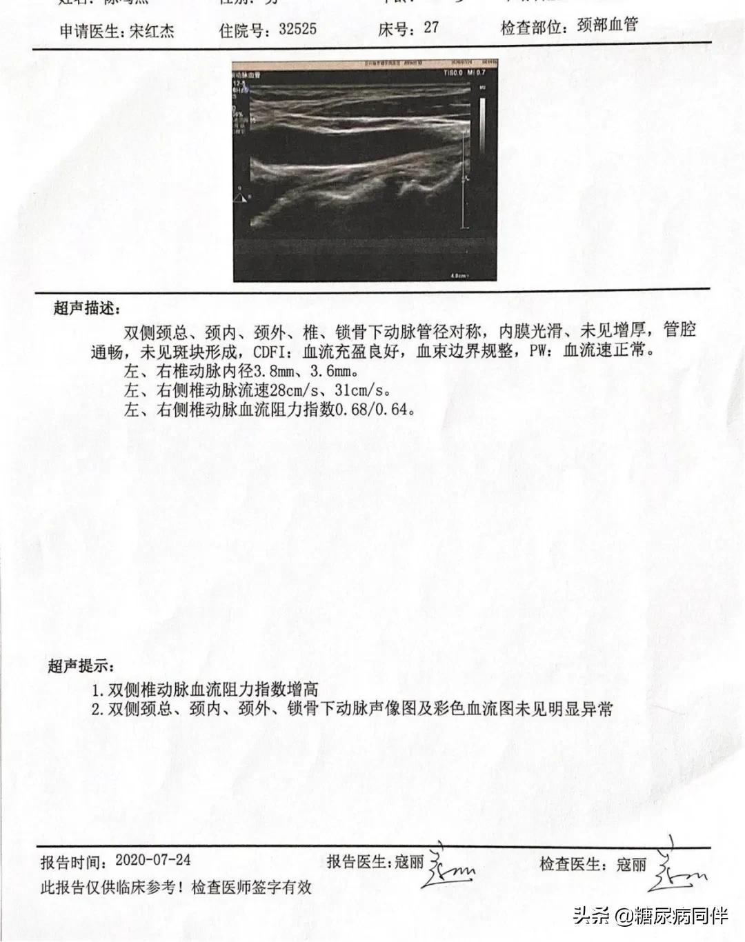 糖尿病新治疗方法逆转,糖尿病的自测与治疗