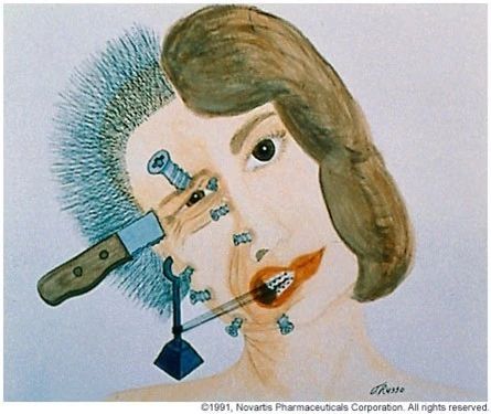 偏头痛的诱发原因,前庭性偏头痛按照偏头痛治疗吗