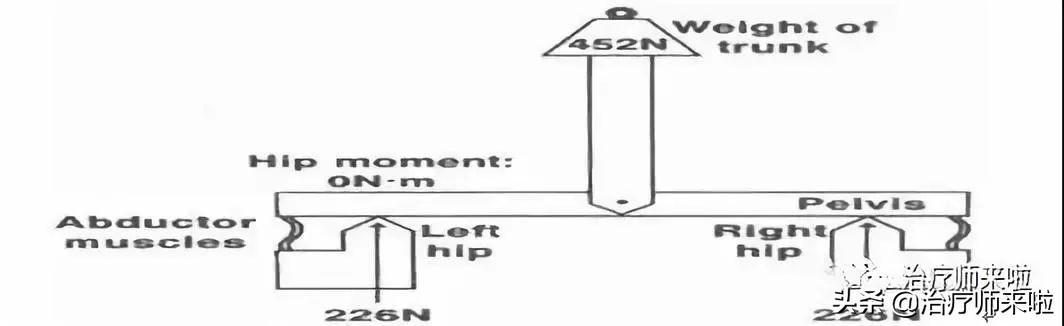 常见的异常步态醉酒步态,步态异常的十大特征有哪些图片